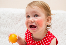 Чем лечить аллергию у ребенка? Причины, симптомы