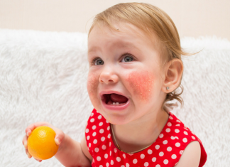 Чем лечить аллергию у ребенка? Причины, симптомы