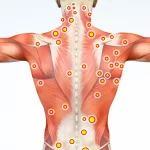 Что такое триггерные точки