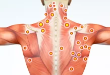 Что такое триггерные точки