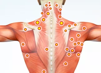 Что такое триггерные точки