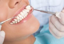 Лечение зубов и важность здоровой улыбки для красоты человека