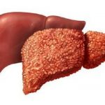 Как выбрать лекарство восстанавливающее печень