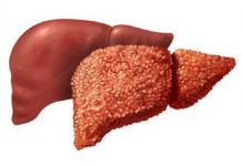 Как выбрать лекарство восстанавливающее печень