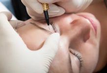 Как проходит лазерная эпиляция бровей