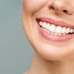 Имплантация зубов: с чего начинать