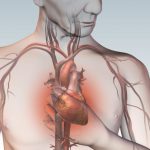 Симптомы ишемической болезни сердца. Как выявить и где лечить?