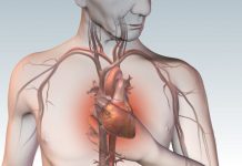 Симптомы ишемической болезни сердца. Как выявить и где лечить?