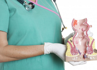 Как бороться с геморроем