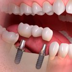 Как выбрать качественную стоматологию