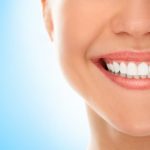 Имплантация зубов – шаг к совершенству