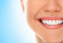 Имплантация зубов – шаг к совершенству