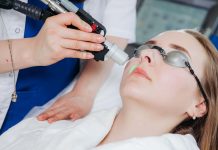 Как проходит процедура лазерной эпиляции над верхней губой