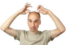 В каких случаях необходима пересадка волос мужчинам