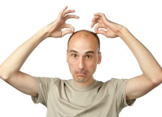В каких случаях необходима пересадка волос мужчинам