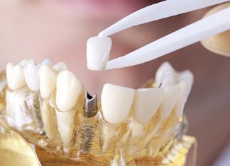 Больно ли ставить коронку на зуб?