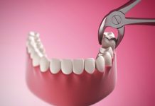 Когда необходимо удаление зуба