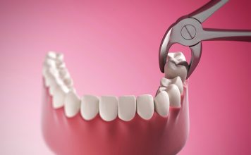 Когда необходимо удаление зуба