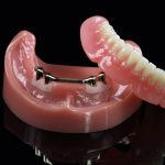 Чем отличается несъемное протезирование зубов