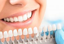 Виды и принципы отбеливания зубов