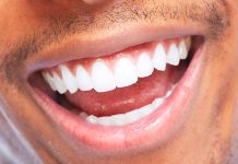 Как происходит установка имплантов