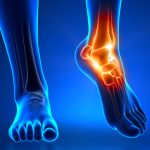 Почему лечение патологии стопы это очень важно