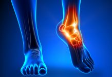 Почему лечение патологии стопы это очень важно