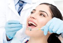 Какими бывают стоматологические импланты