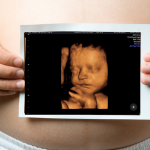 На каком сроке лучше делать 3D УЗИ при беременности