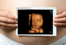 На каком сроке лучше делать 3D УЗИ при беременности