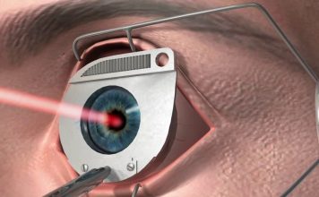 Методы лечения в офтальмологии