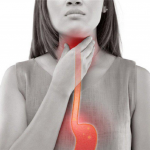 Гастроэзофагеальная рефлюксная болезнь: причины, симптомы, лечение