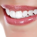 Имплантация зубов: показания и противопоказания