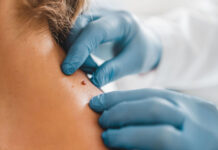 Что такое рак кожи и как его лечить