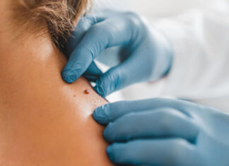 Что такое рак кожи и как его лечить