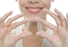 Элайнеры Star Smile: преимущества для врачей