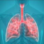 Медицинское оборудование ЛПУ, предназначенное для респираторной терапии и энтерального питания