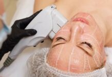 Особенности ультразвукового SMAS-лифтинга