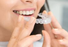 Что такое элайнеры и в чем их преимущества