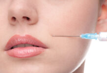 Что такое филлеры и где их используют