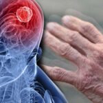 Паркинсонизм: понятие, признаки, лечение