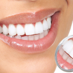 Подходы к выбору типа имплантата при замене зубов: сравнительный анализ преимуществ и недостатков