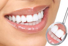 Подходы к выбору типа имплантата при замене зубов: сравнительный анализ преимуществ и недостатков