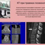 Диагностика заболеваний поясничного отдела позвоночника при помощи компьютерной томографии (КТ) в Украине