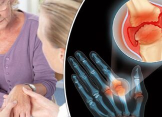 Новые тенденции в диагностике и лечении заболеваний суставов: актуальные проблемы и перспективы