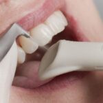 Зубной камень: причины образования, последствия и методы профилактики