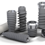 Преимущества имплантационной системы Straumann: передовые технологии для здоровой улыбки