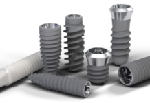 Преимущества имплантационной системы Straumann: передовые технологии для здоровой улыбки