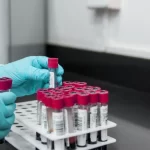 Биохимический анализ крови: когда и зачем его проводят?