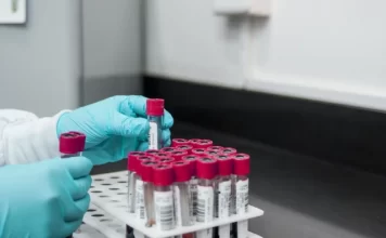 Биохимический анализ крови: когда и зачем его проводят?